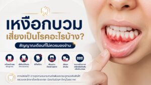 Gum Swelling Cover