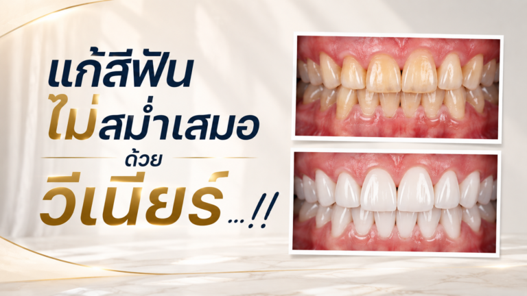 4aa16d2a 1c55 48b1 9fd7 98a09b71eef9