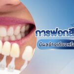 Blog 1727906721