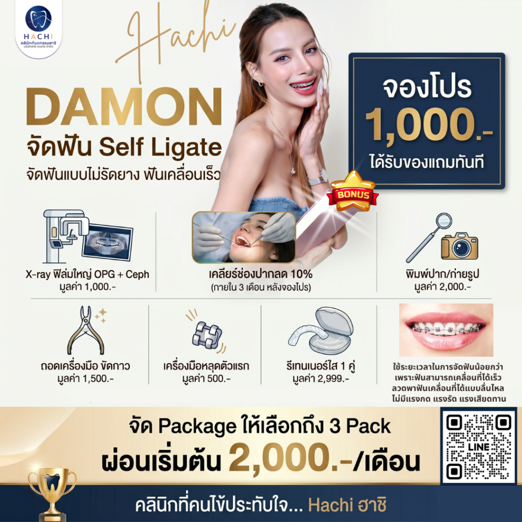 ภาพโปรโมชั่น Aw (27)