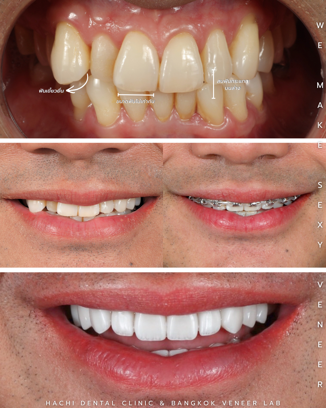 Before and After Case 2