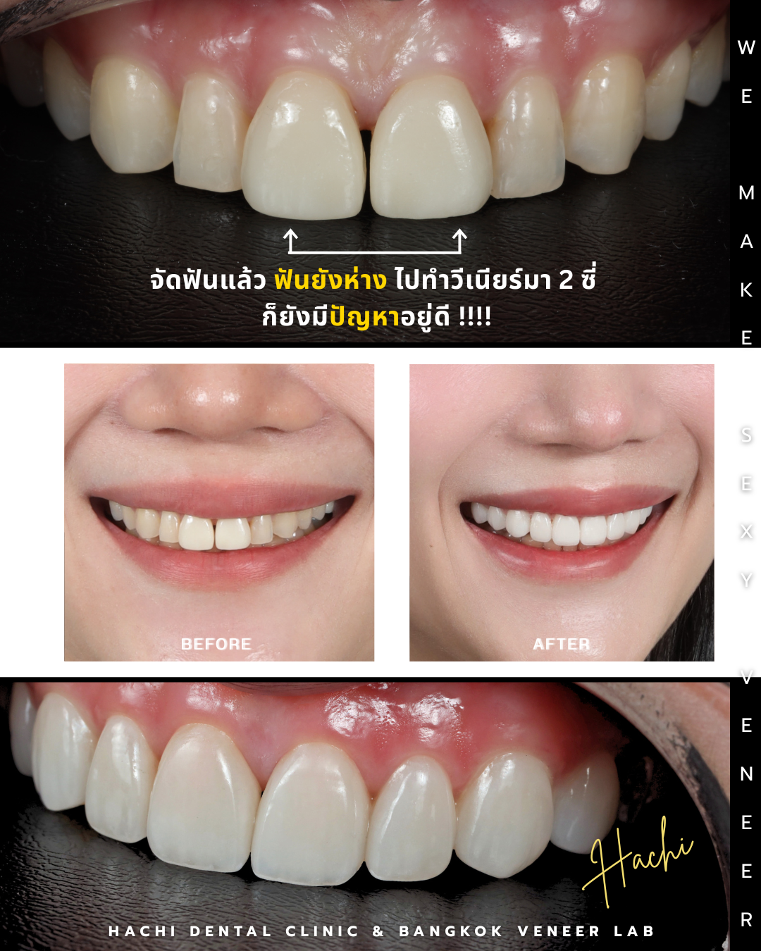 Before and After Case 1