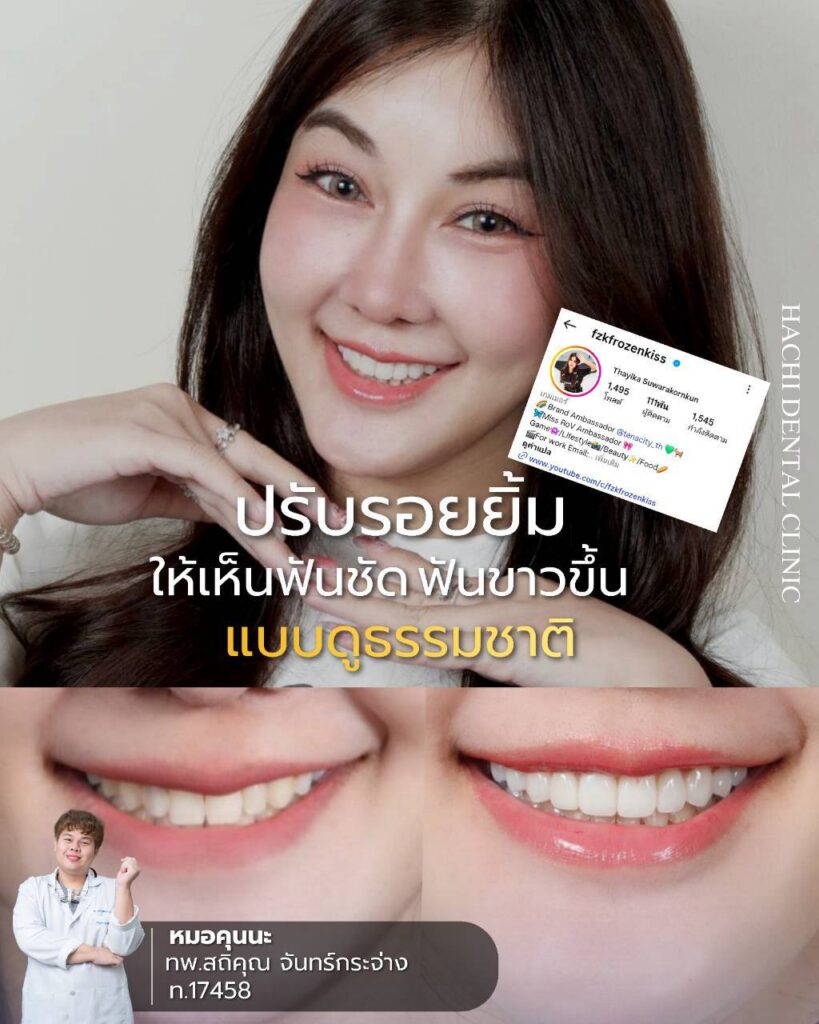 Line Album เคสk.แนน🥰 260727 1