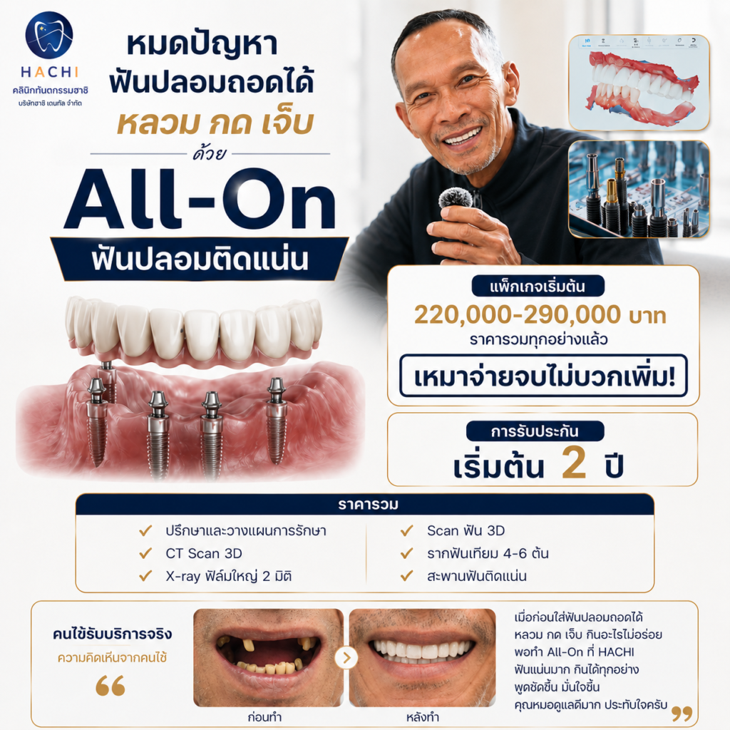 All On 4 6 Promotion