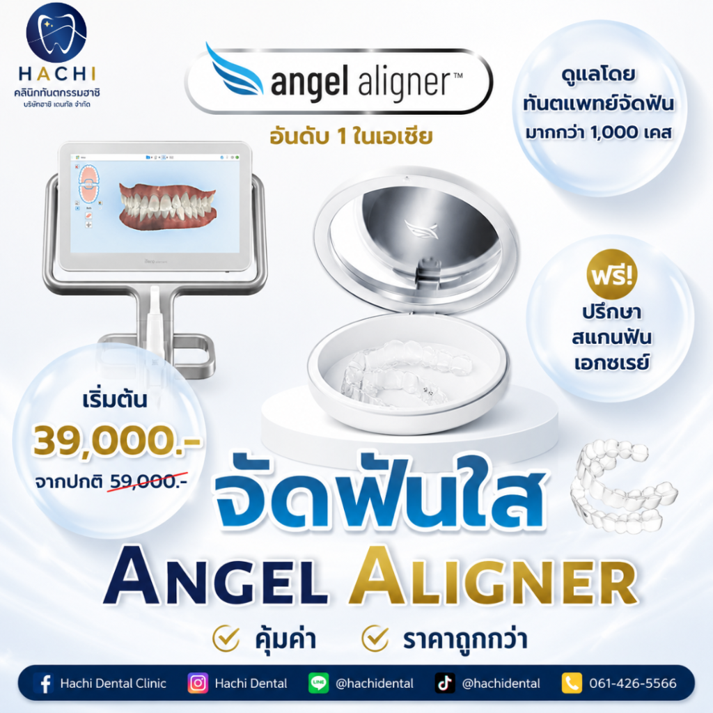 Angel Aligner