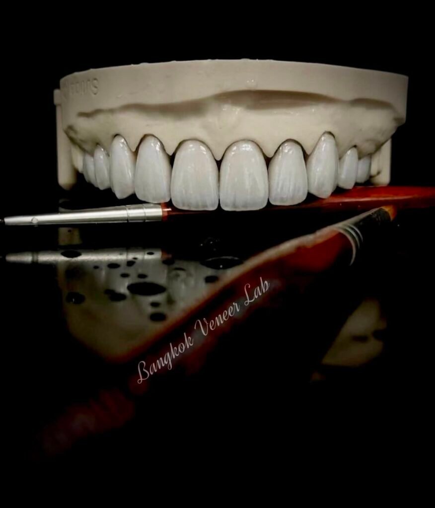 Bangkok Veneer Lab Cast Brush
