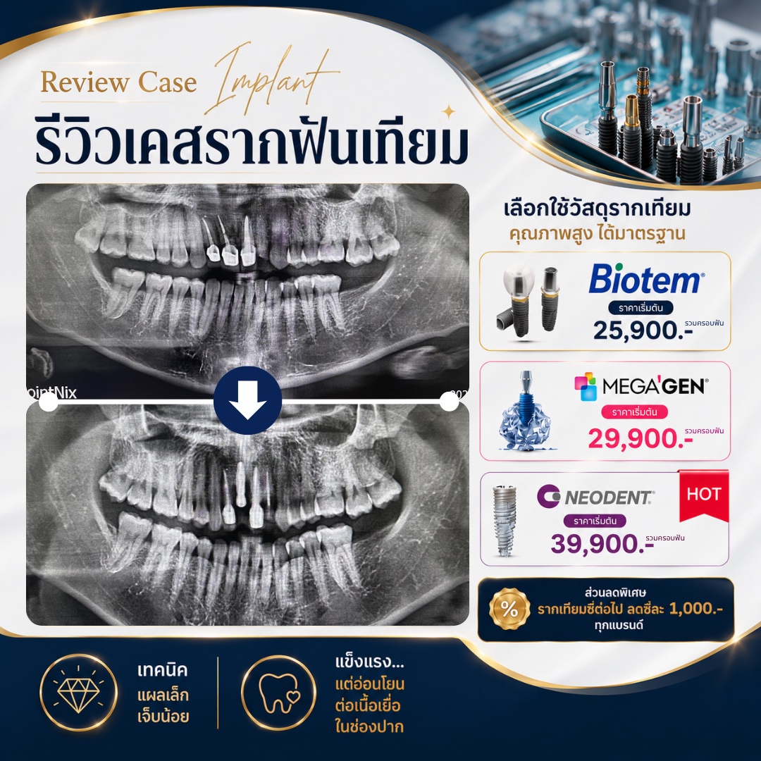 รีวิวรากฟันเทียม Hachi Dental ภาพ 24
