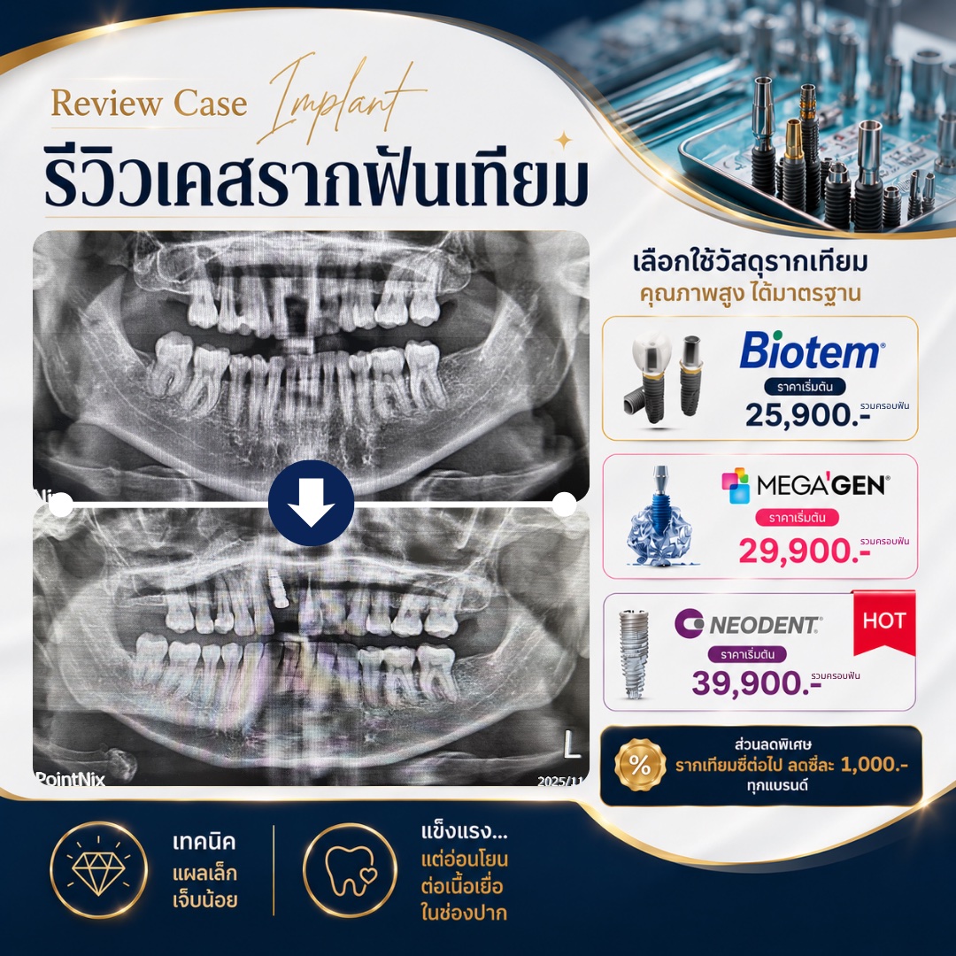 รีวิวรากฟันเทียม Hachi Dental ภาพ 26