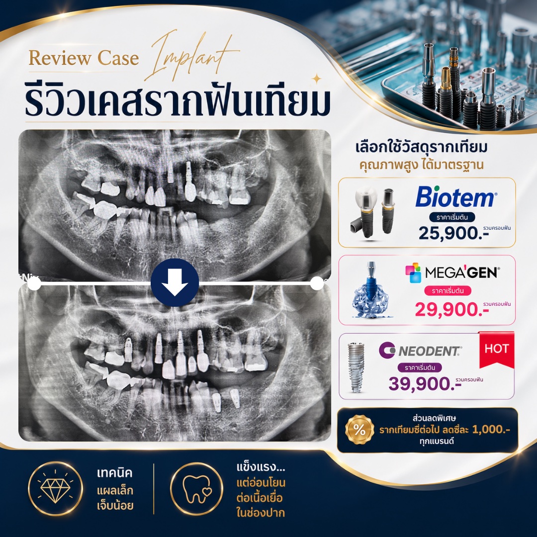 รีวิวรากฟันเทียม Hachi Dental ภาพ 28