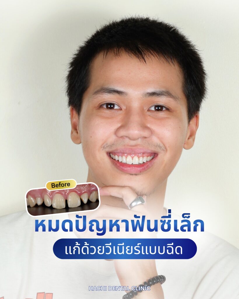 Review 1