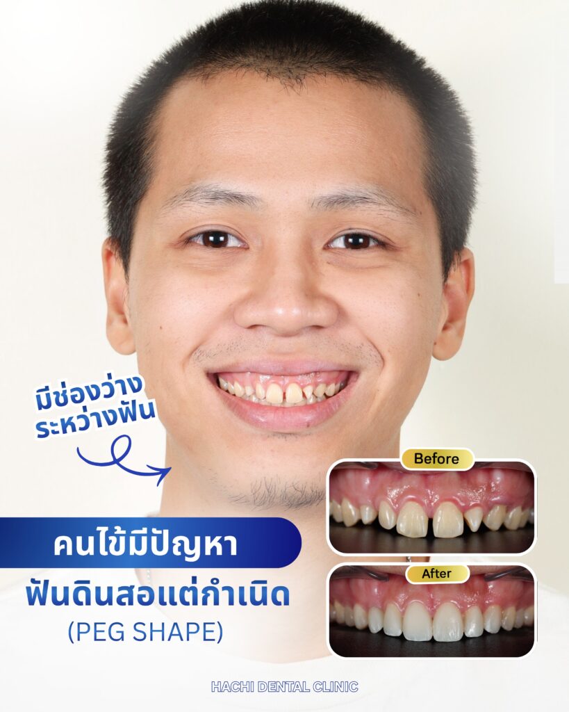 Review 3