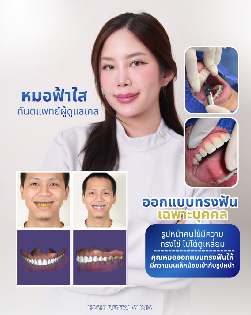 Review 4