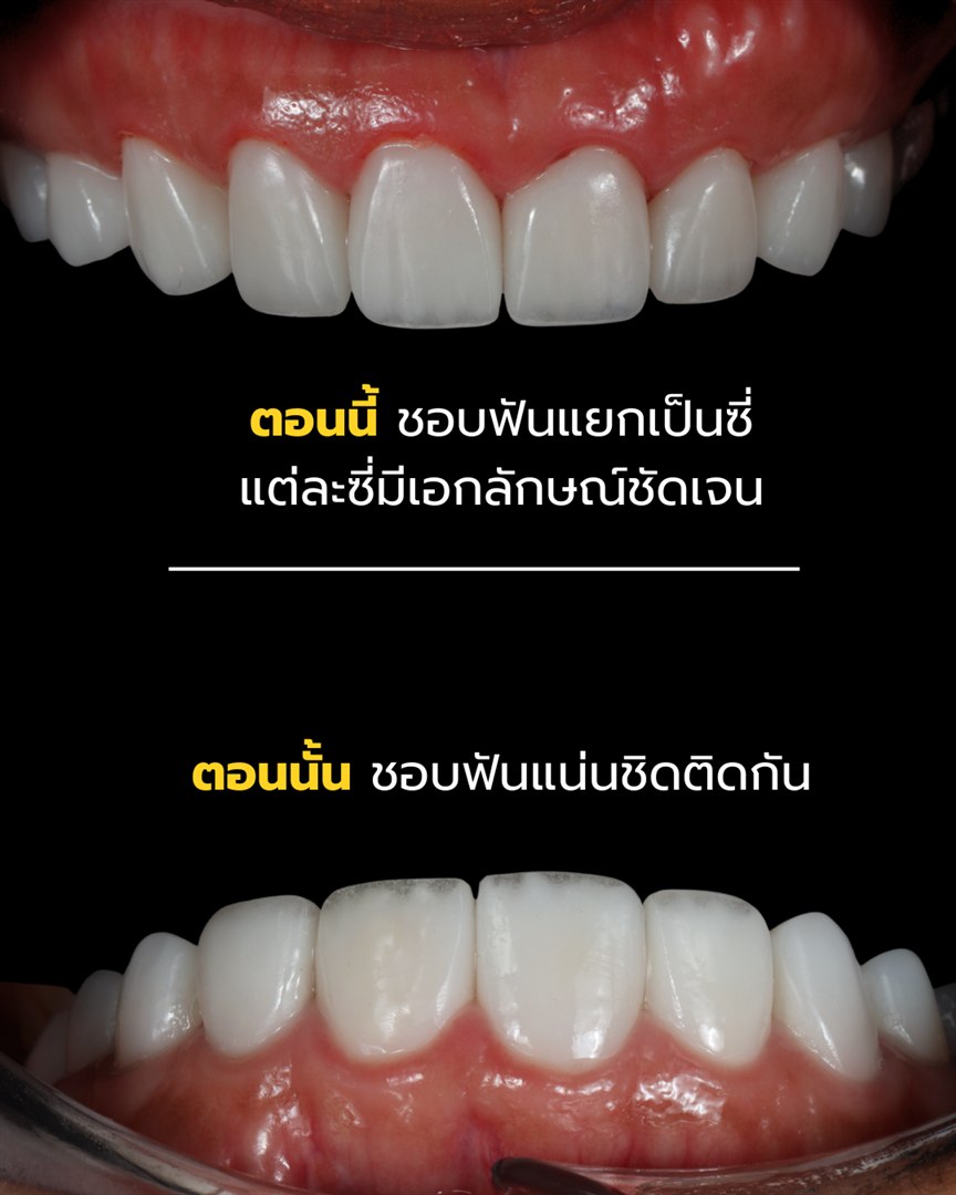 Before and After Case 2