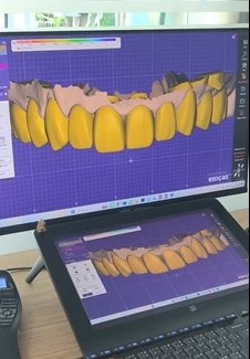 Veneer Cad Design Software