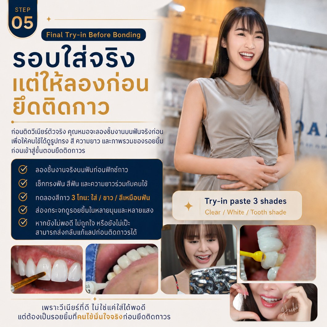 ขั้นตอนการทำวีเนียร์ ขั้นตอนที่ 5 ลองชิ้นงานก่อนยึดติดถาวร
