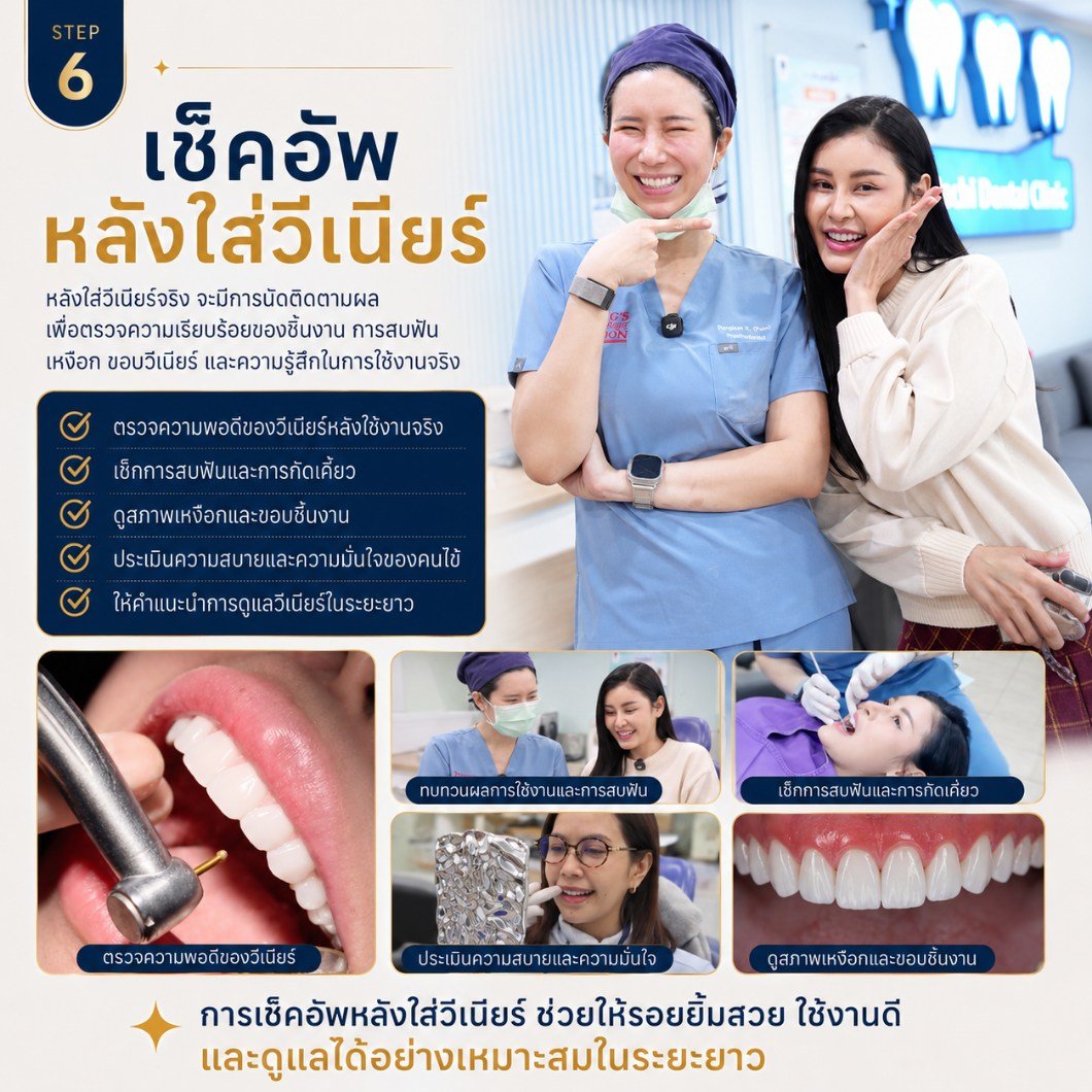 ขั้นตอนการทำวีเนียร์ ขั้นตอนที่ 6 เช็กอัพหลังใส่วีเนียร์