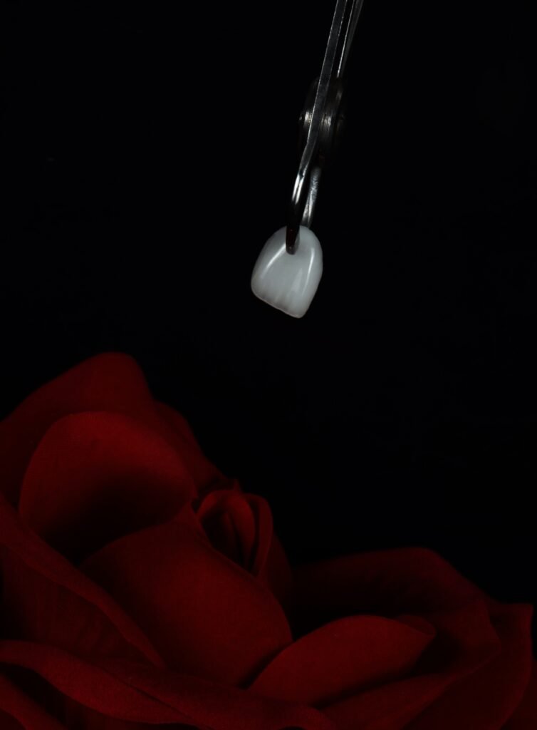 Veneer Rose Artistic