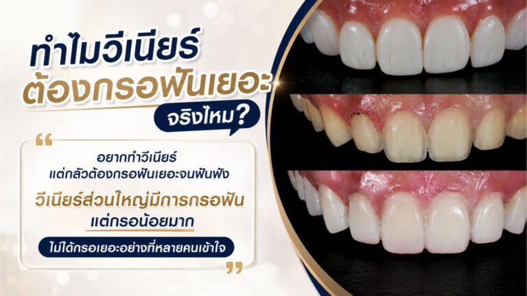 ดีไซน์ที่ยังไม่ได้ตั้งชื่อ