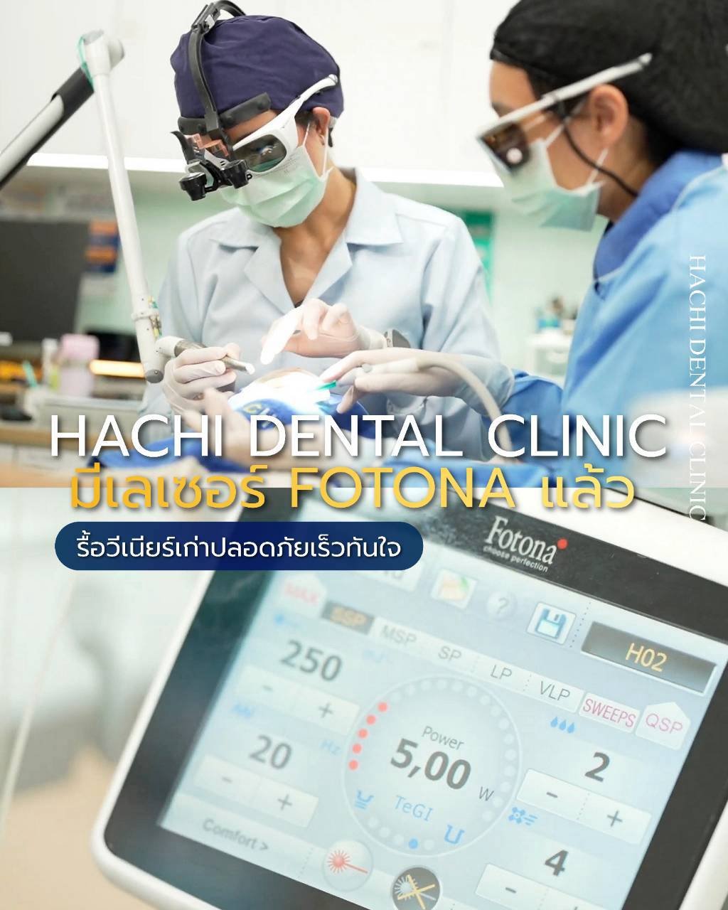 Hachi Dental Clinic มีเครื่องเลเซอร์ Fotona รื้อวีเนียร์เก่าปลอดภัยและรวดเร็ว