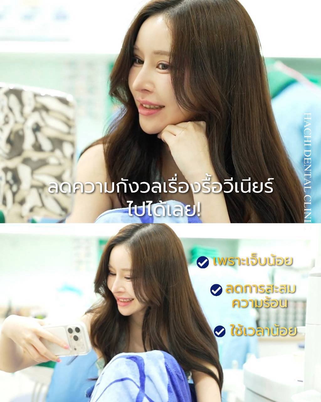 ลดความกังวลเรื่องรื้อวีเนียร์เก่า เจ็บน้อย ลดความร้อนสะสม ใช้เวลาน้อย